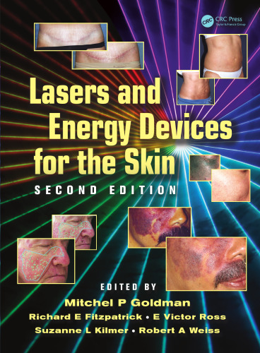 Lasers and energy devices for the skin