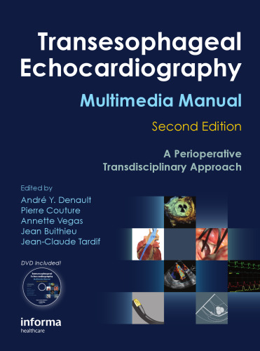 Transesophageal echocardiography multimedia manual : a perioperative transdisciplinary approach