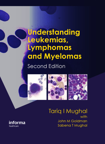 Understanding leukemias, lymphomas, and myelomas