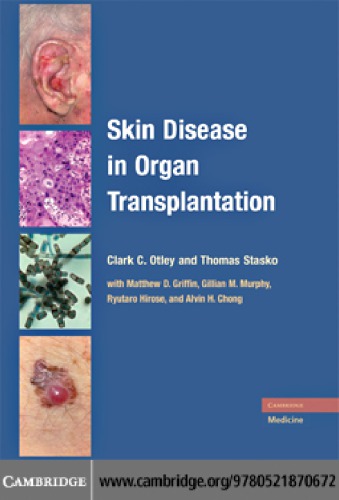Skin disease in organ transplantation