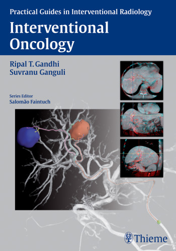 Interventional oncology