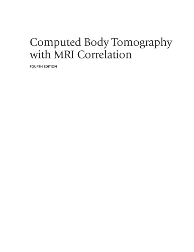 Computed Body Tomography with MRI Correlation