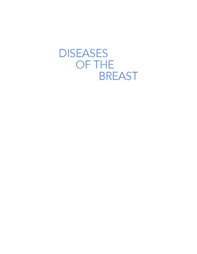 Diseases of the breast