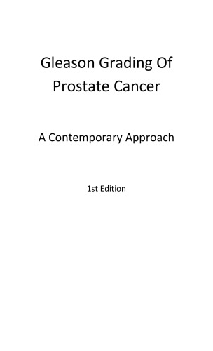 Gleason grading of prostate cancer : a contemporary approach