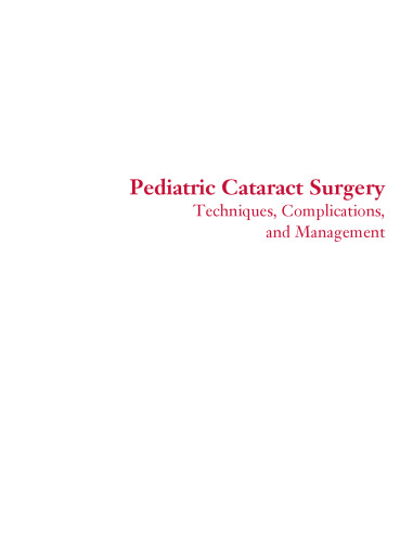 Pediatric cataract surgery : techniques, complications, and management