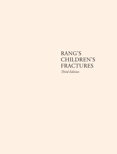 Rang's children's fractures