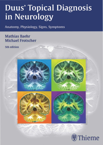 Duus’ Topical Diagnosis in Neurology: Anatomy, Physiology, Signs, Symptoms