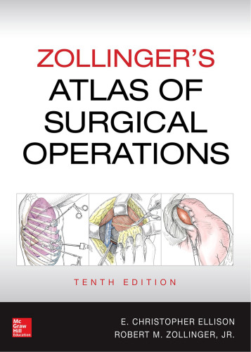 Zollinger’s Atlas of Surgical Operations