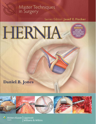 Hernia