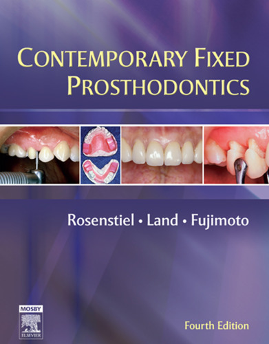 Contemporary fixed prosthodontics