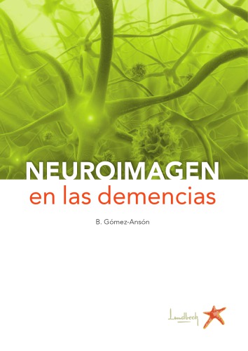 Neuroimagen en las Demencias