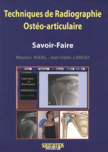 Techniques de radiographie ostéo-articulaire
