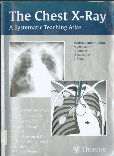 The Chest X-Ray-The Systematic Teaching Atlas.