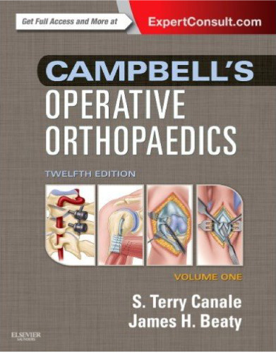 Campbell’s Operative Orthopaedics: 4-Volume Set