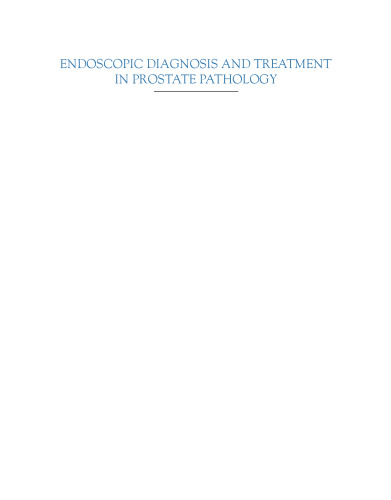 Endoscopic Diagnosis and Treatment in Prostate Pathology. Handbook of Endourology