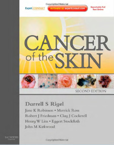 Cancer of the Skin: Expert Consult - Online and Print, 2e