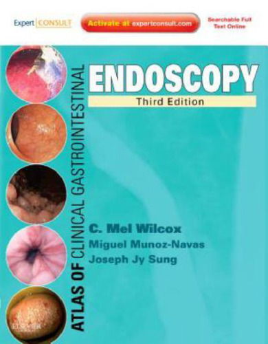 Atlas of Clinical Gastrointestinal Endoscopy: Expert Consult - Online and Print, 3e