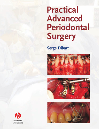 Practical Advanced Periodontal Surgery