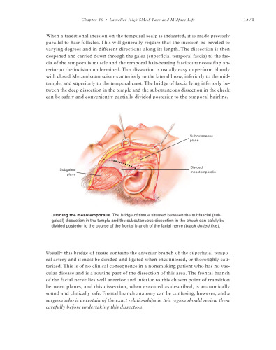 The Art of Aesthetic Surgery: Principles and Techniques, Three Volume Set, part 2