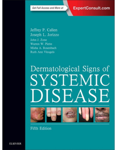 Dermatological Signs of Systemic Disease