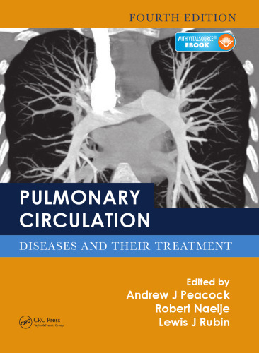 Pulmonary Circulation: Diseases and Their Treatment