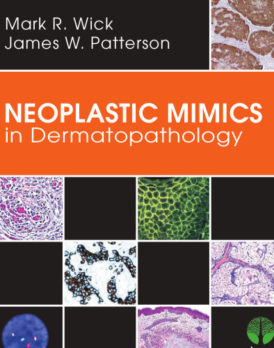 Neoplastic Mimics in Dermatopathology