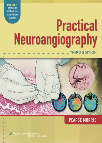 Practical Neuroangiography