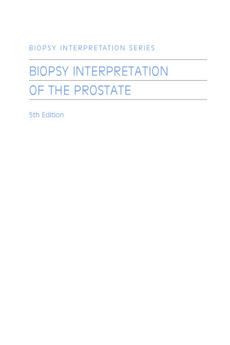 Biopsy Interpretation of the Prostate