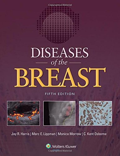 Diseases of the Breast 5e