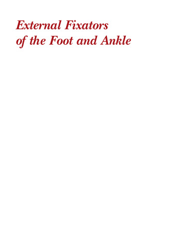 External Fixators of the Foot and Ankle