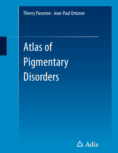 Atlas of Pigmentary Disorders