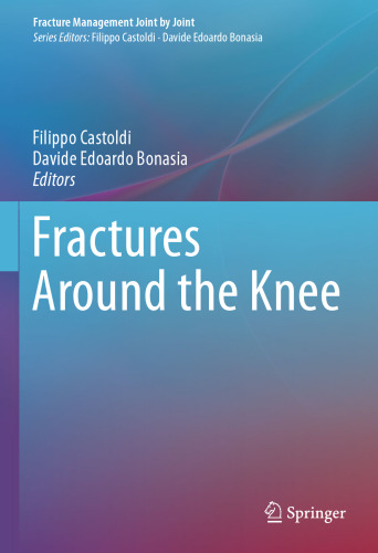 Fractures Around the Knee