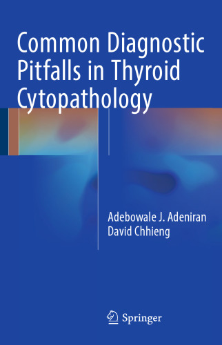Common Diagnostic Pitfalls in Thyroid Cytopathology
