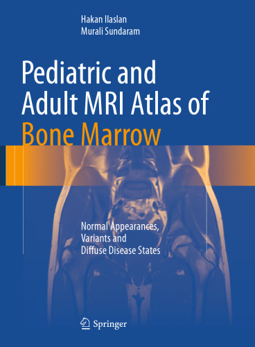 Pediatric and Adult MRI Atlas of Bone Marrow: Normal Appearances, Variants and Diffuse Disease States