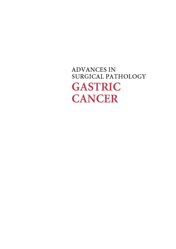 Advances in Surgical Pathology: Gastric Cancer