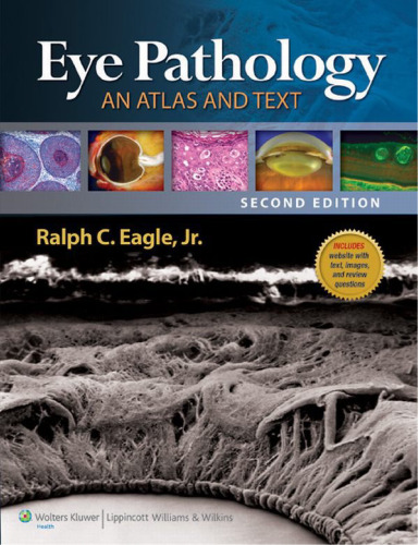 Eye Pathology: An Atlas and Text