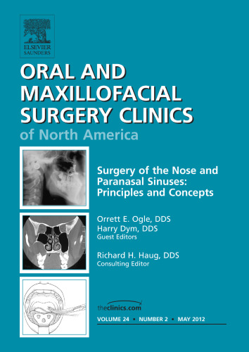 Surgery of the Nose and Paranasal Sinuses: Principles and Concepts, An Issue of Oral and Maxillofacial Surgery Clinics, 1e
