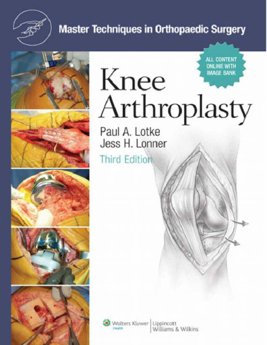 Master Techniques in Orthopaedic Surgery: Knee Arthroplasty