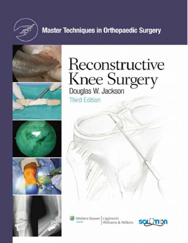 Reconstructive Knee Surgery