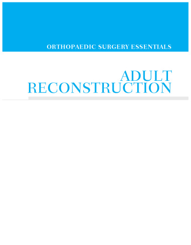 Adult Reconstruction