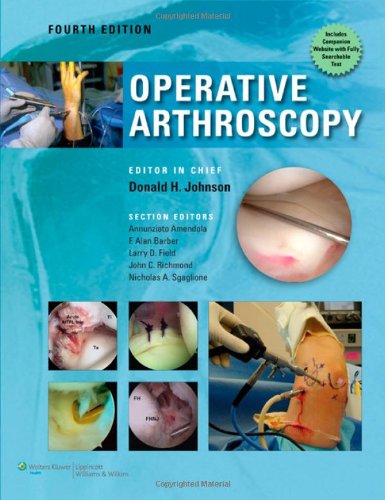 Operative Arthroscopy