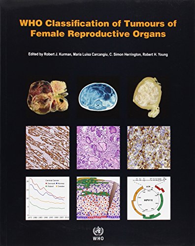 WHO Classification of Tumours of the Female Reproductive Organs