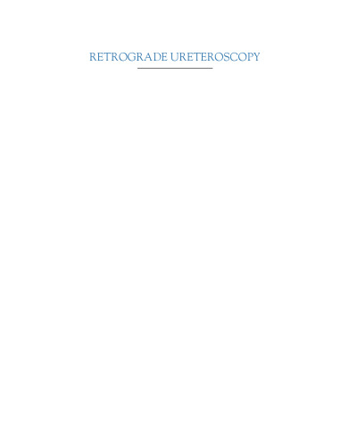 Retrograde Ureteroscopy. Handbook of Endourology