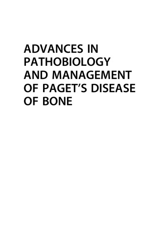 Advances in Pathobiology and Management of Paget’s Disease of Bone
