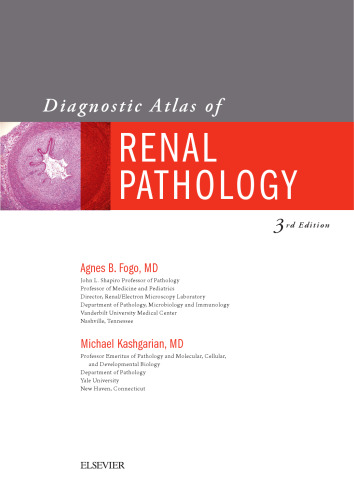 Diagnostic Atlas of Renal Pathology