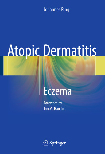 Atopic Dermatitis: Eczema
