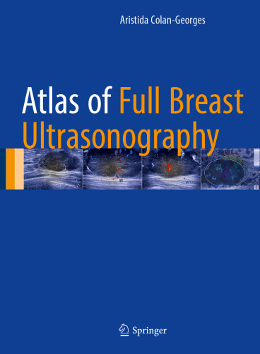 Atlas of Full Breast Ultrasonography