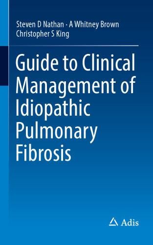 Guide to Clinical Management of Idiopathic Pulmonary Fibrosis