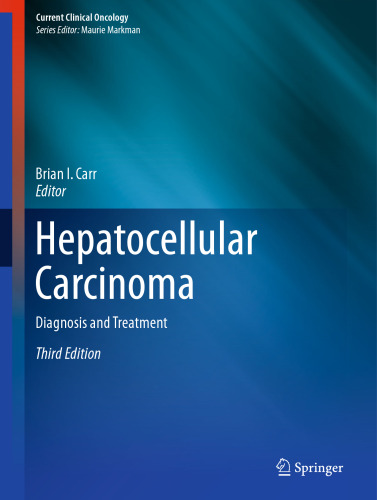 Hepatocellular Carcinoma: Diagnosis and Treatment