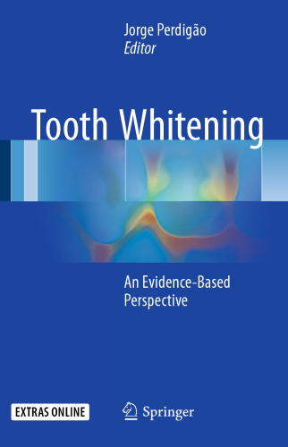 Tooth Whitening: An Evidence-Based Perspective